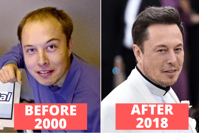 How Did Elon Musk Grow His Hair Back