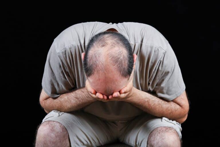 How to Deal With Hair Loss Depression